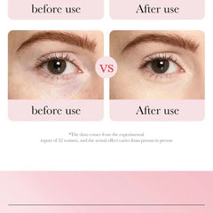 Fading Wrinkle Eye Bag Care