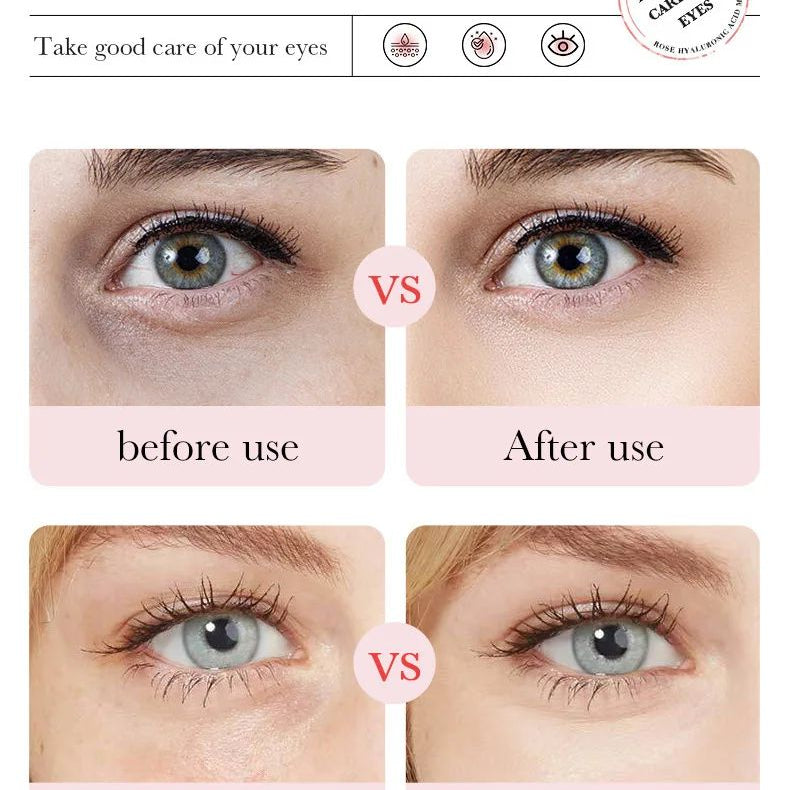 Fading Wrinkle Eye Bag Care