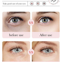 Fading Wrinkle Eye Bag Care